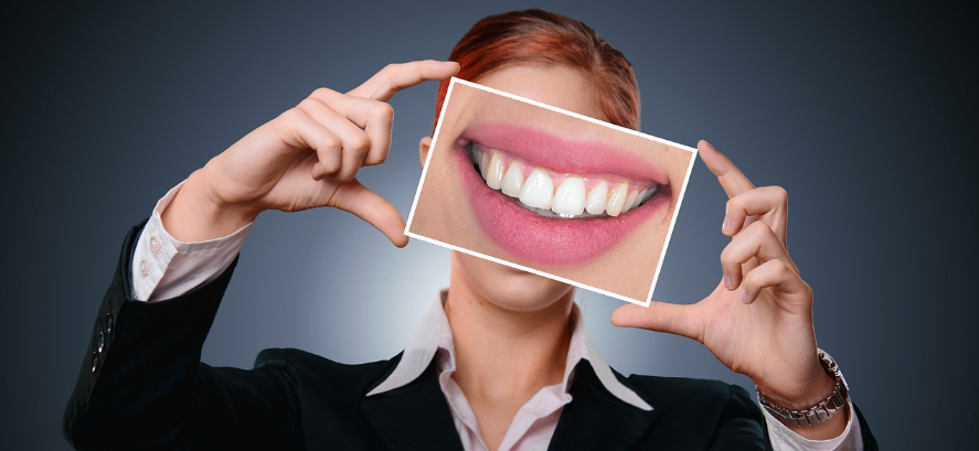 white teeth
